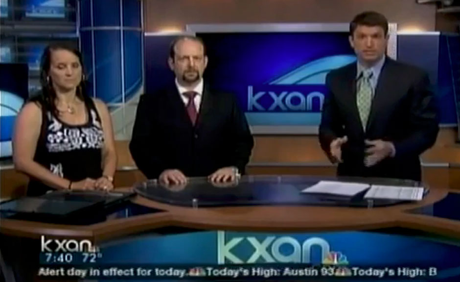 Dr. Weinfeld discusses Treatment of Migraine Headaches – BOTOX® on KXAN 36